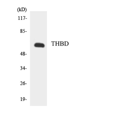 Western Blot - Anti-THBD Antibody (R12-3621) - Antibodies.com