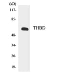 Western Blot - Anti-THBD Antibody (R12-3621) - Antibodies.com