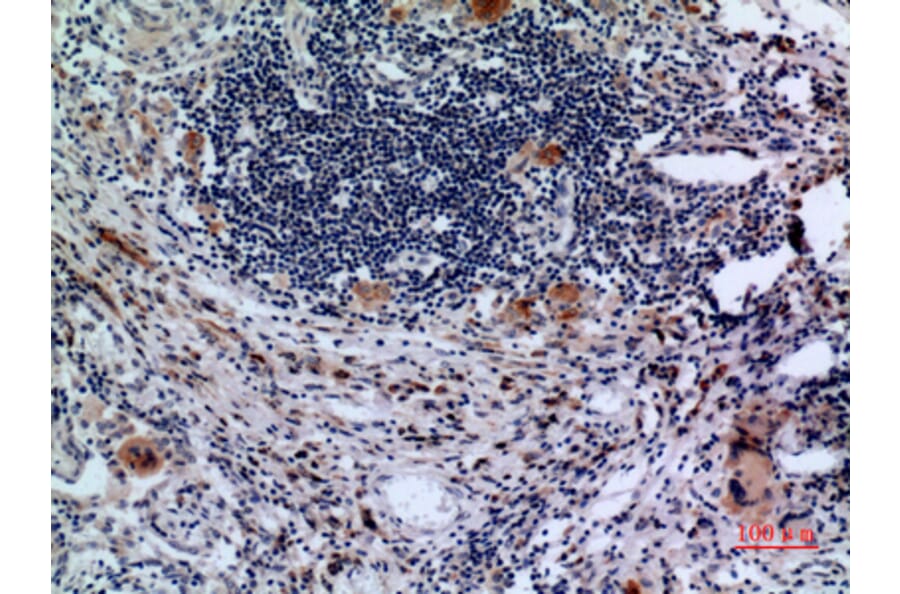 Immunohistochemistry - Anti-TFRC Antibody (C30157) - Antibodies.com