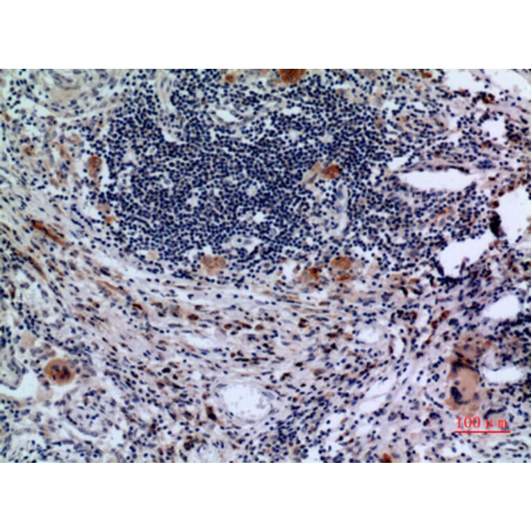 Immunohistochemistry - Anti-TFRC Antibody (C30157) - Antibodies.com