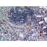 Immunohistochemistry - Anti-TFRC Antibody (C30157) - Antibodies.com