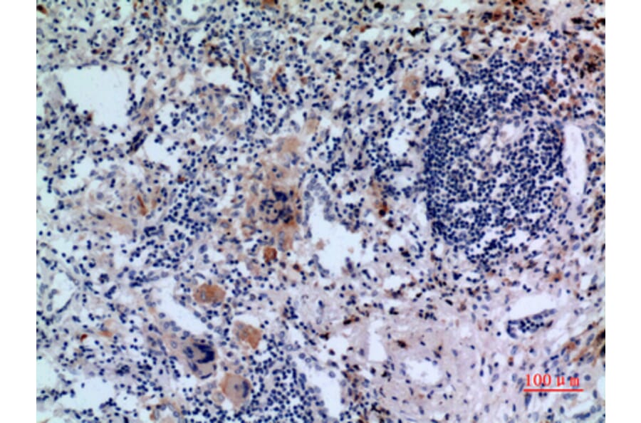 Immunohistochemistry - Anti-TFRC Antibody (C30157) - Antibodies.com