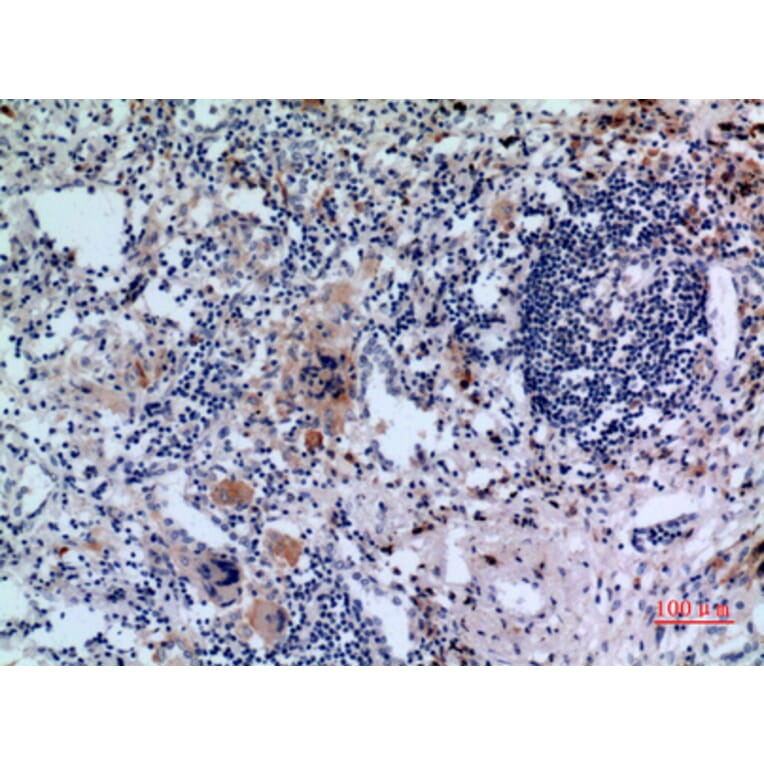 Immunohistochemistry - Anti-TFRC Antibody (C30157) - Antibodies.com