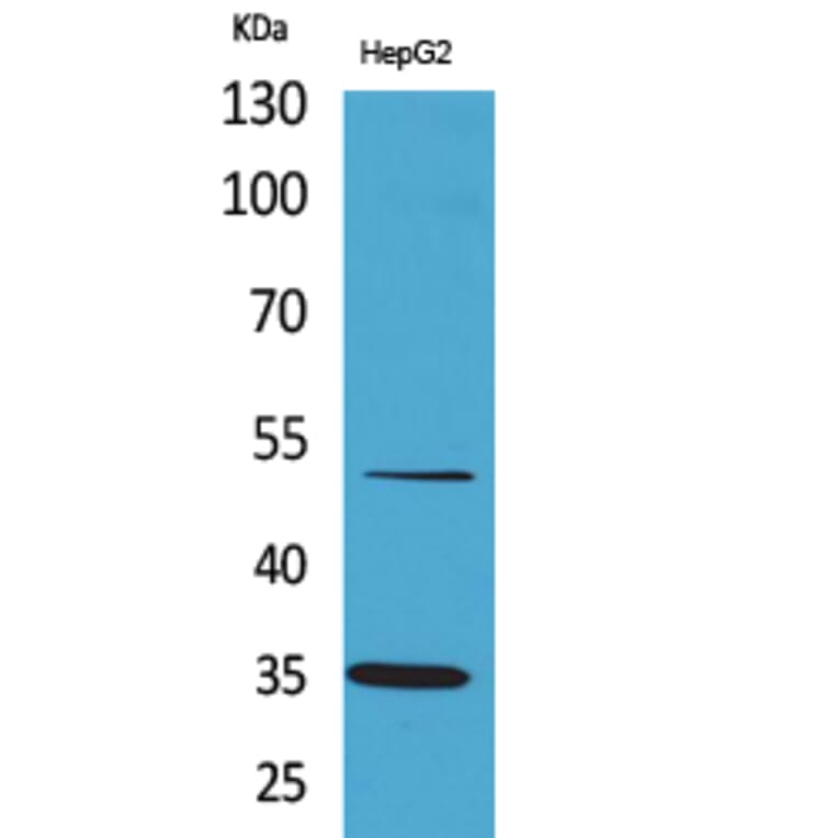 Western Blot - Anti-TFPI Antibody (C30304) - Antibodies.com