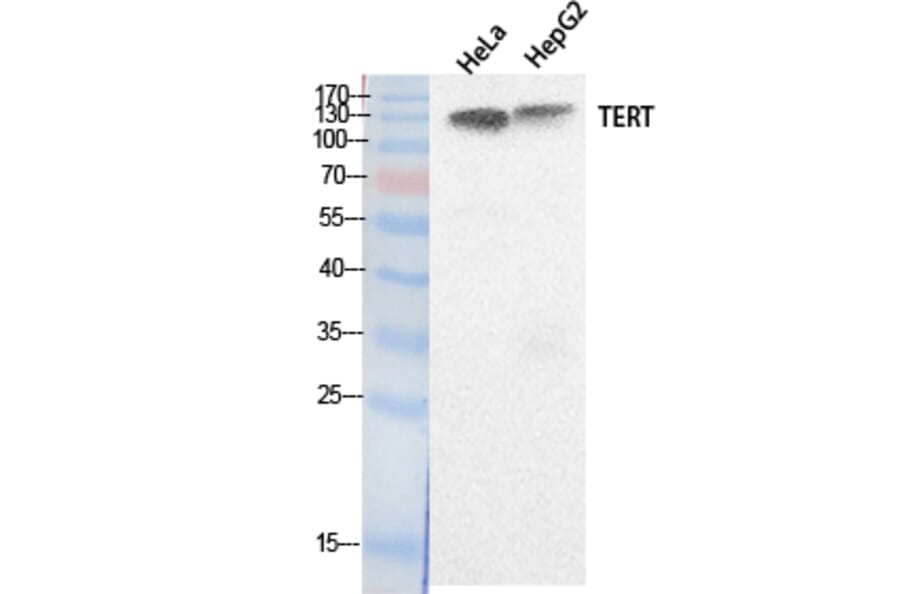 Western Blot - Anti-TERT Antibody (C30042) - Antibodies.com