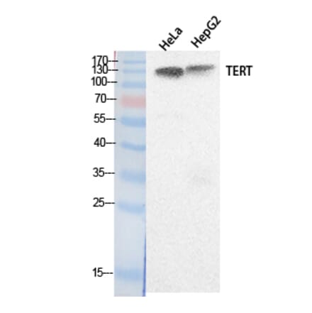 Western Blot - Anti-TERT Antibody (C30042) - Antibodies.com