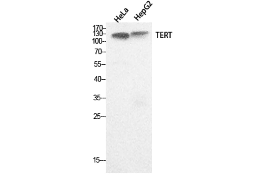 Western Blot - Anti-TERT Antibody (C30042) - Antibodies.com