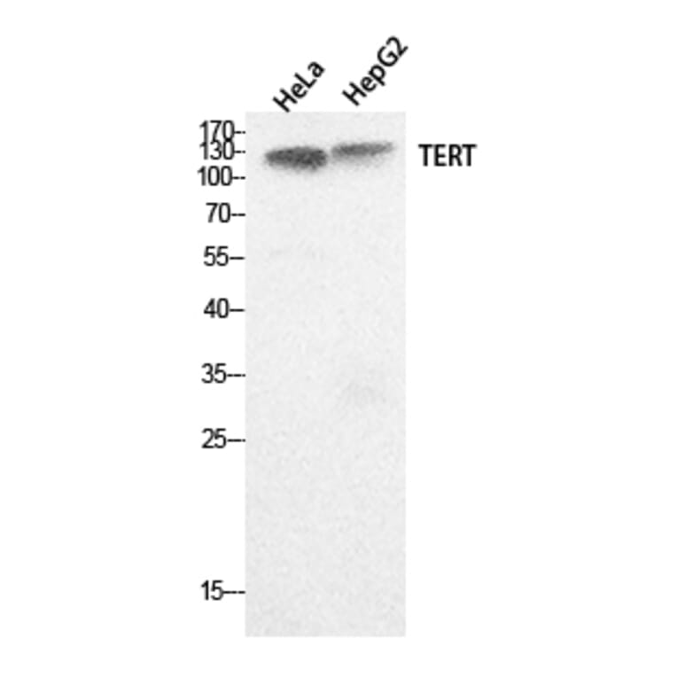 Western Blot - Anti-TERT Antibody (C30042) - Antibodies.com