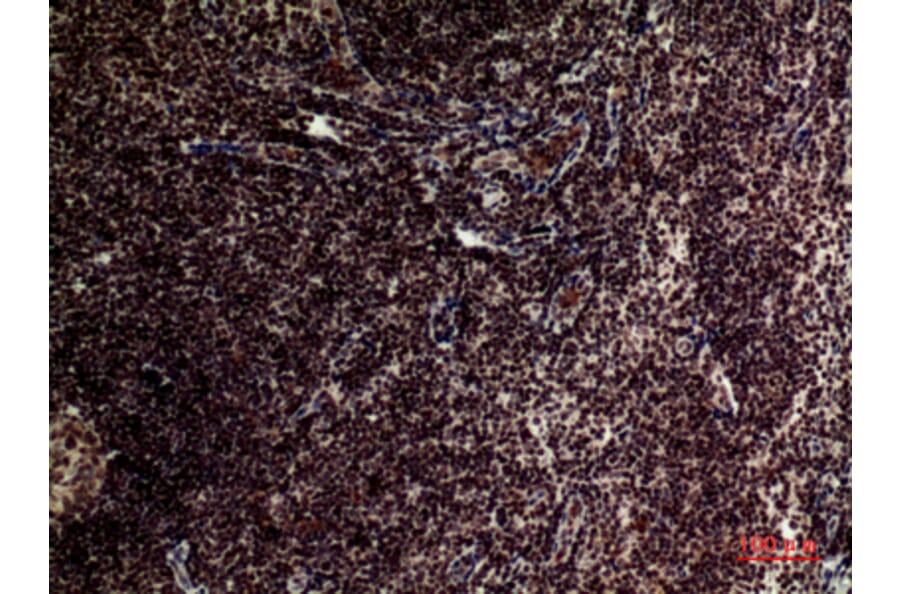 Immunohistochemistry - Anti-TERT Antibody (C30042) - Antibodies.com
