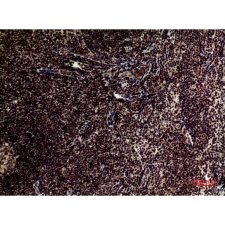 Immunohistochemistry - Anti-TERT Antibody (C30042) - Antibodies.com