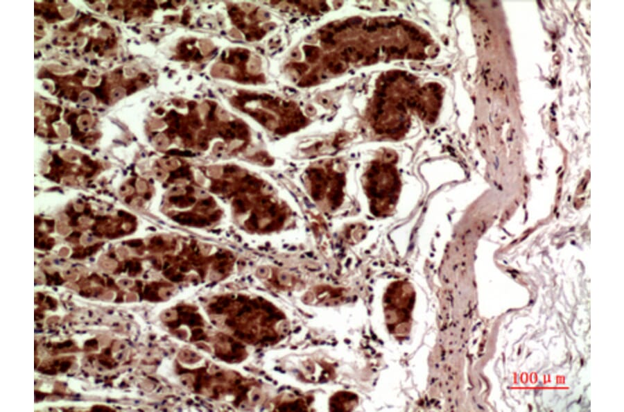 Immunohistochemistry - Anti-TERT Antibody (C30042) - Antibodies.com