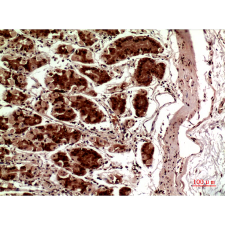 Immunohistochemistry - Anti-TERT Antibody (C30042) - Antibodies.com