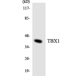 Western Blot - Anti-TBX1 Antibody (R12-3602) - Antibodies.com
