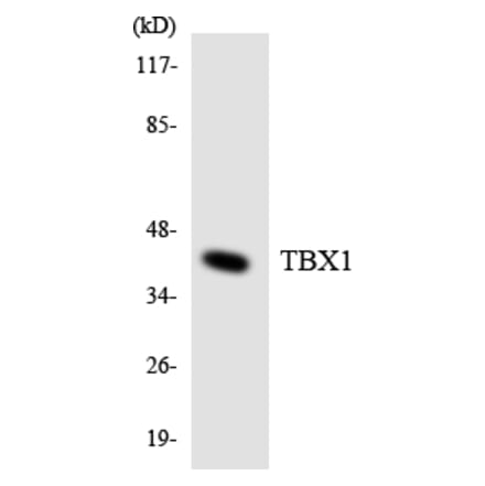 Western Blot - Anti-TBX1 Antibody (R12-3602) - Antibodies.com