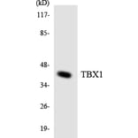 Western Blot - Anti-TBX1 Antibody (R12-3602) - Antibodies.com