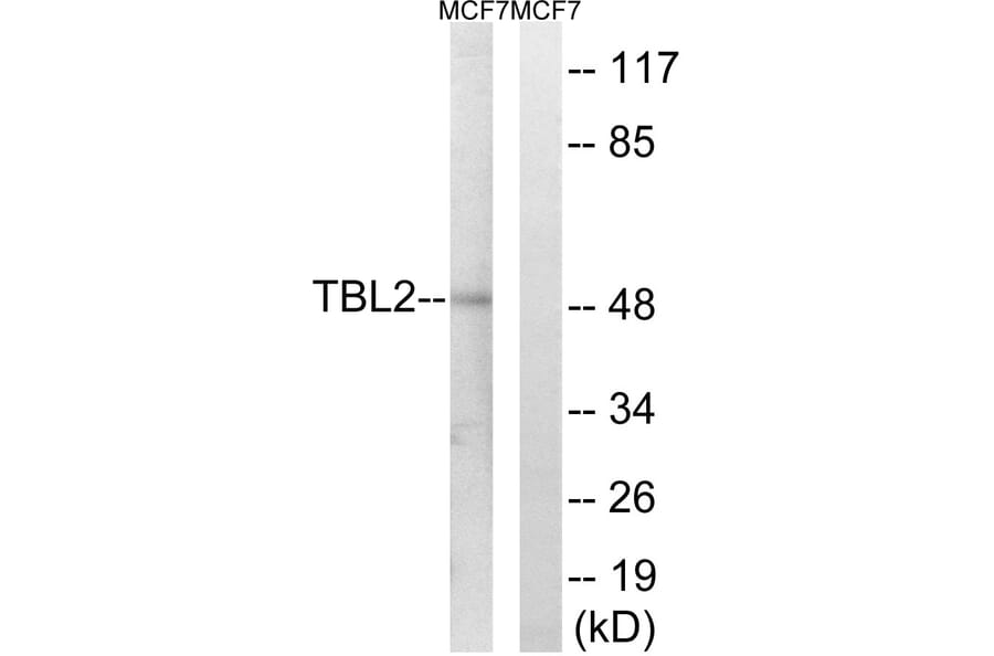 Western Blot - Anti-TBL2 Antibody (C19258) - Antibodies.com