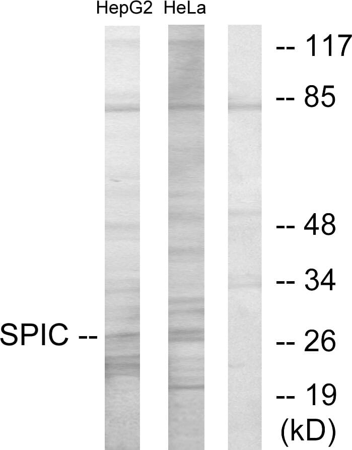 Anti-SPIC Antibody (A101297) | Antibodies.com