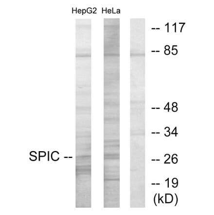 Western Blot - Anti-SPIC Antibody (C11346) - Antibodies.com