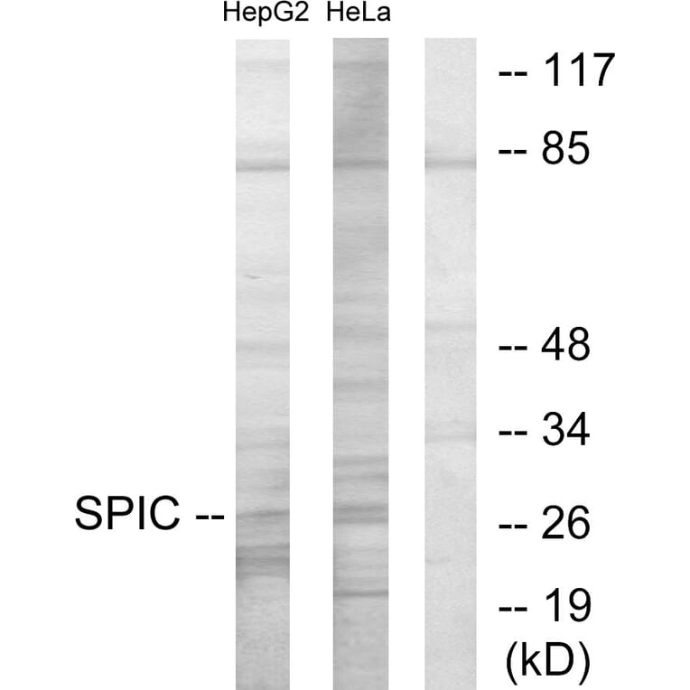 Western Blot - Anti-SPIC Antibody (C11346) - Antibodies.com