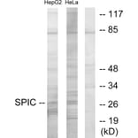 Western Blot - Anti-SPIC Antibody (C11346) - Antibodies.com