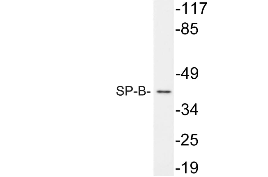 Western Blot - Anti-SP-B Antibody (R12-2366) - Antibodies.com