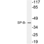 Western Blot - Anti-SP-B Antibody (R12-2366) - Antibodies.com