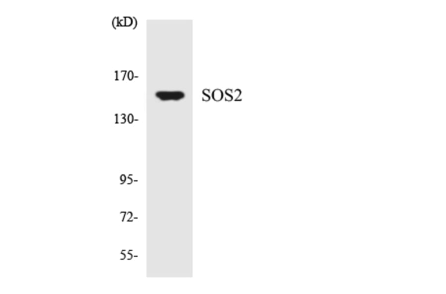 Western Blot - Anti-SOS2 Antibody (R12-3550) - Antibodies.com