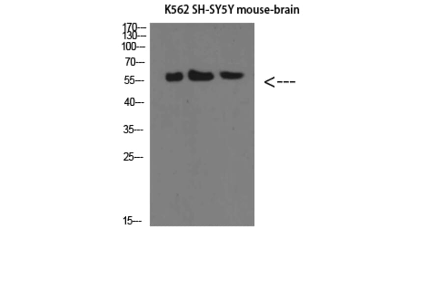 Western Blot - Anti-SELE Antibody (C30167) - Antibodies.com