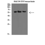 Western Blot - Anti-SELE Antibody (C30167) - Antibodies.com