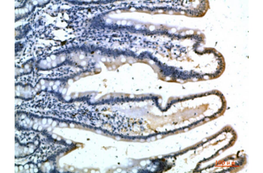 Immunohistochemistry - Anti-SELE Antibody (C30167) - Antibodies.com