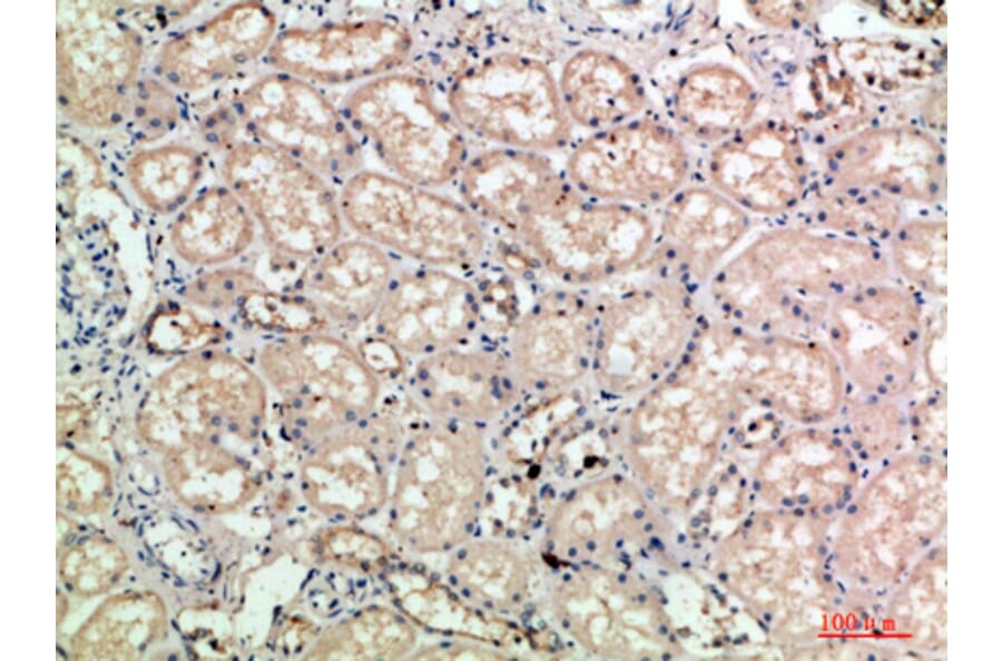 Immunohistochemistry - Anti-SELE Antibody (C30167) - Antibodies.com