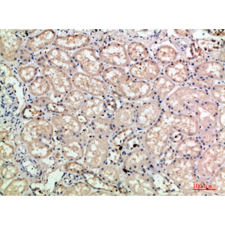 Immunohistochemistry - Anti-SELE Antibody (C30167) - Antibodies.com