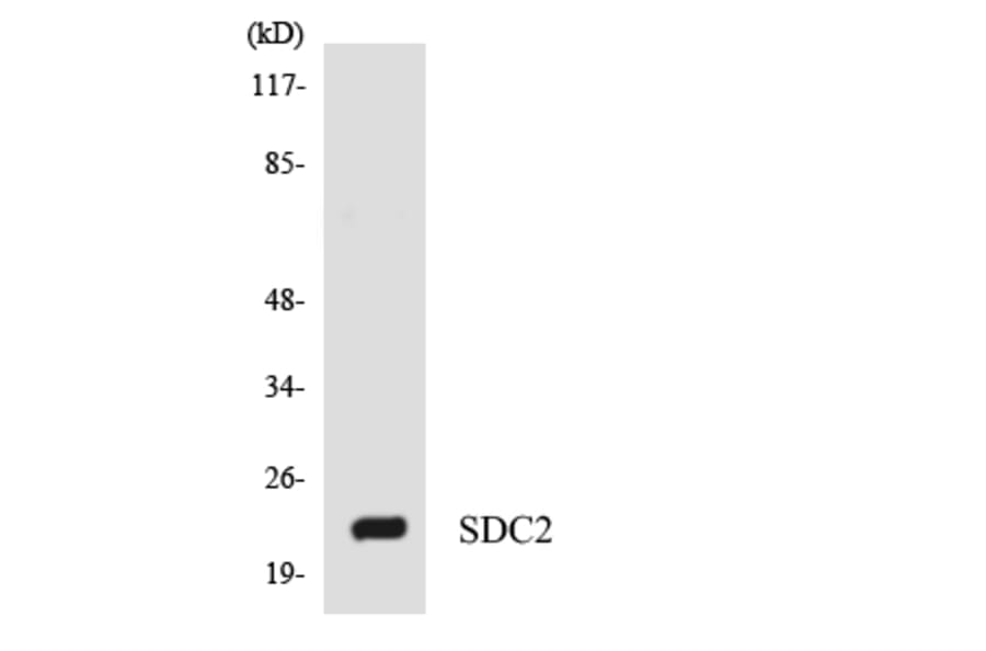 Western Blot - Anti-SDC2 Antibody (R12-3487) - Antibodies.com