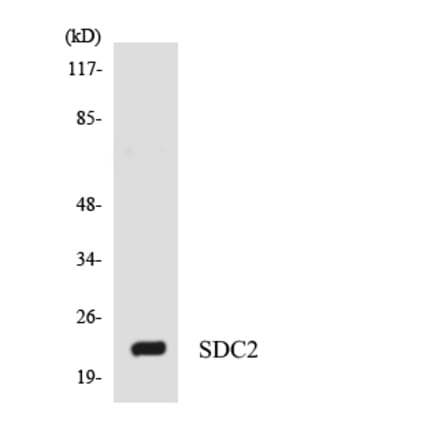 Western Blot - Anti-SDC2 Antibody (R12-3487) - Antibodies.com