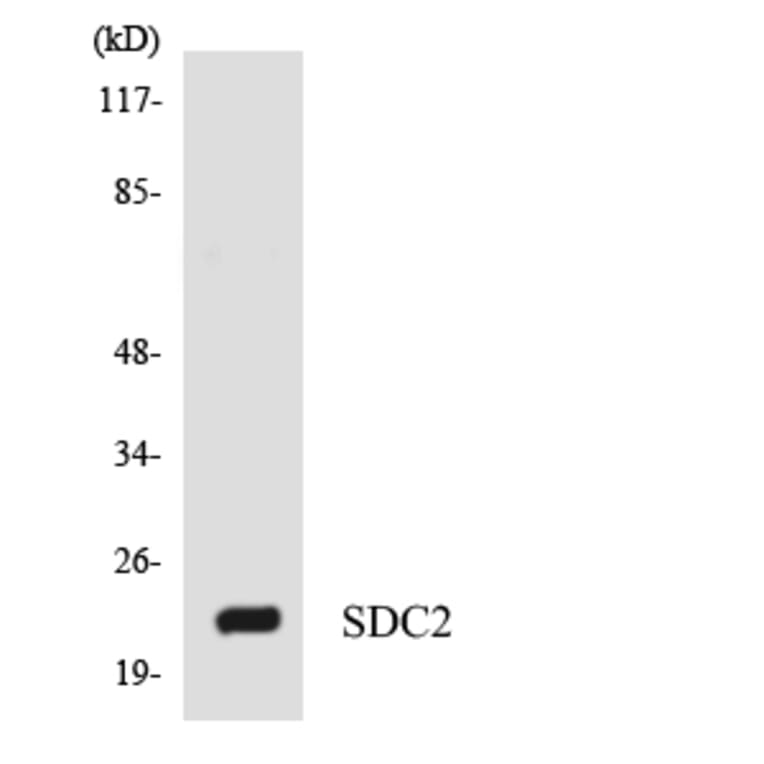 Western Blot - Anti-SDC2 Antibody (R12-3487) - Antibodies.com