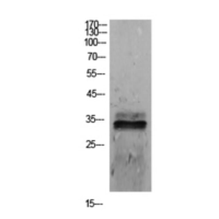 Western Blot - Anti-SDC1 Antibody (C30432) - Antibodies.com