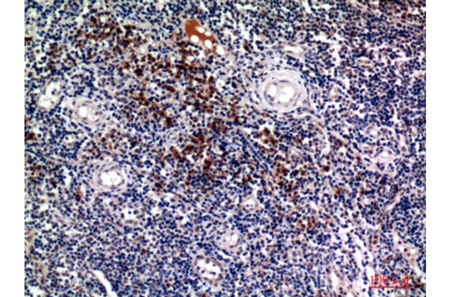 Immunohistochemistry - Anti-SDC1 Antibody (C30432) - Antibodies.com