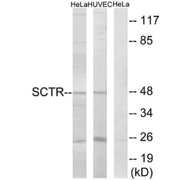Western Blot - Anti-SCTR Antibody (G742) - Antibodies.com