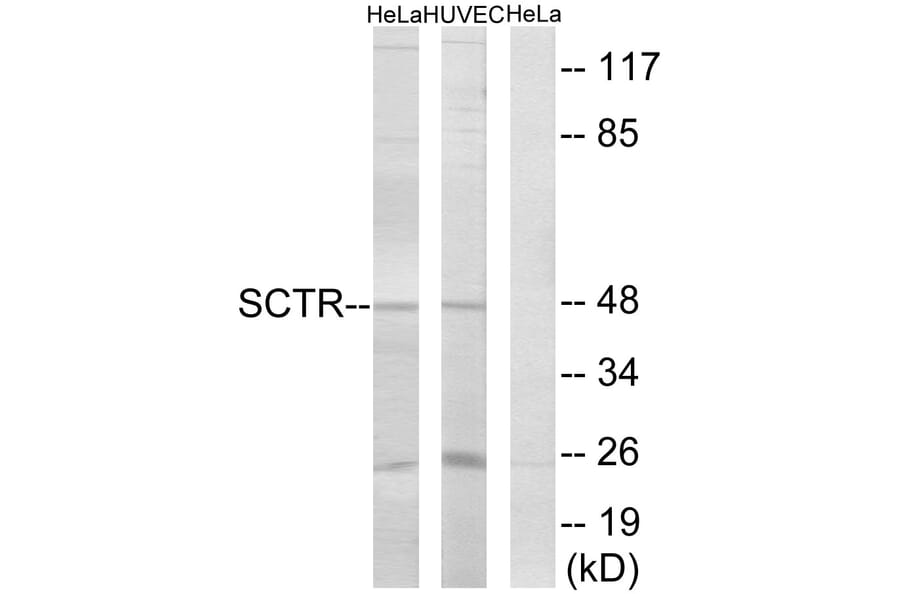 Western Blot - Anti-SCTR Antibody (G742) - Antibodies.com