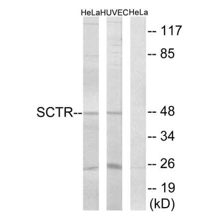Western Blot - Anti-SCTR Antibody (G742) - Antibodies.com