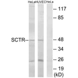 Western Blot - Anti-SCTR Antibody (G742) - Antibodies.com