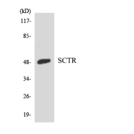 Western Blot - Anti-SCTR Antibody (R12-3485) - Antibodies.com