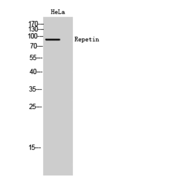 Western Blot - Anti-RPTN Antibody (C18335) - Antibodies.com