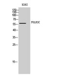 Western Blot - Anti-RPC3 Antibody (C15476) - Antibodies.com