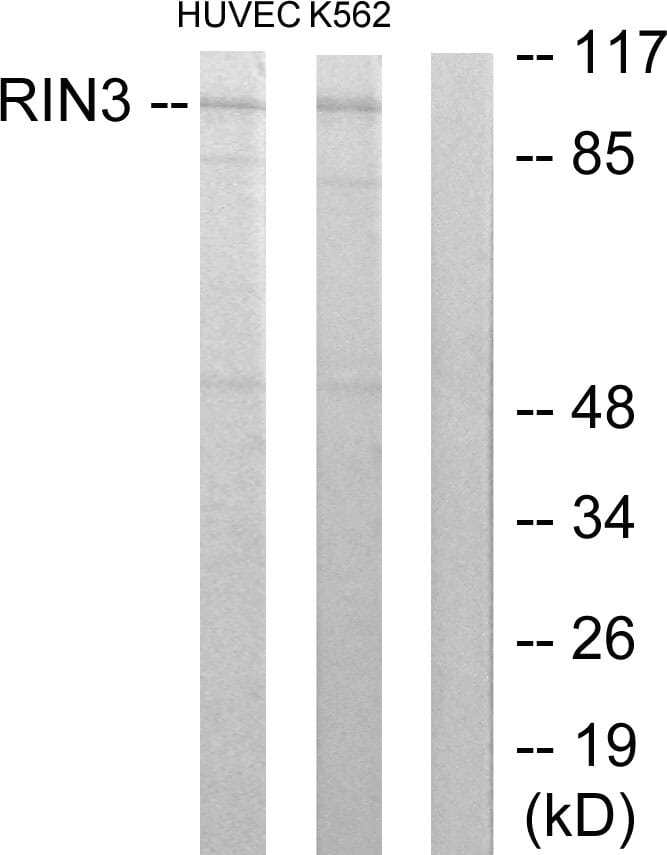 Western blot analysis of lysates from HUVEC and K562 cells using Anti-RIN3 Antibody. The right hand lane represents a negative control, where the antibody is blocked by the immunising peptide.