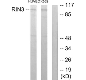 Western Blot - Anti-RIN3 Antibody (C11385) - Antibodies.com