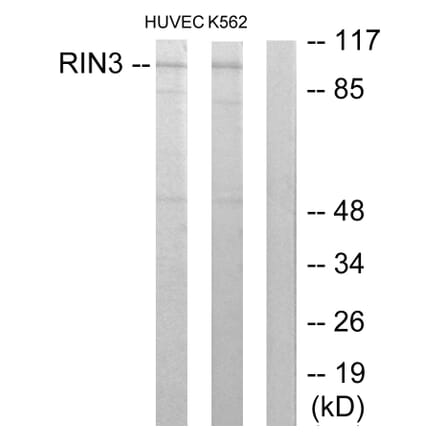 Western Blot - Anti-RIN3 Antibody (C11385) - Antibodies.com