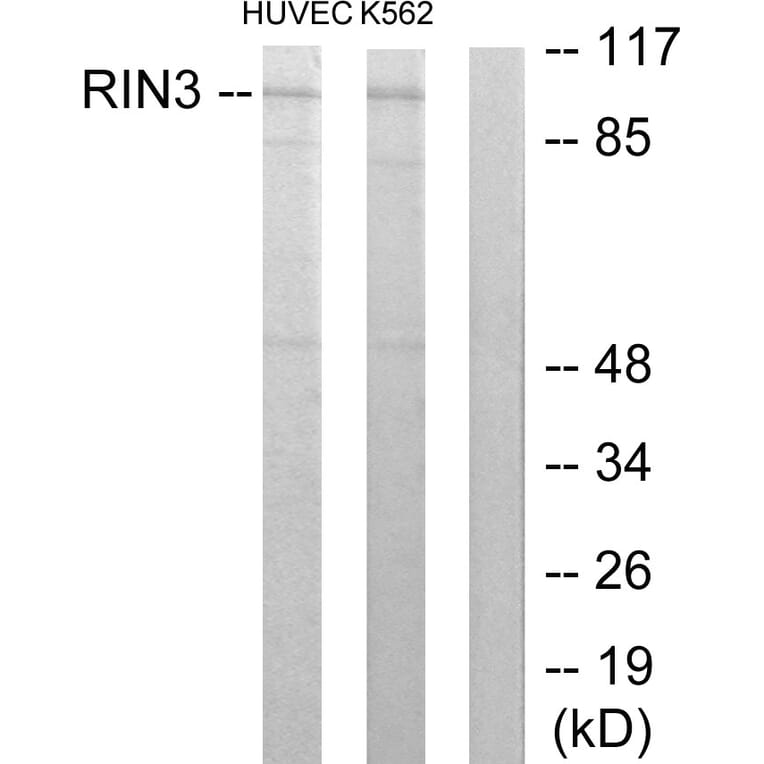 Western Blot - Anti-RIN3 Antibody (C11385) - Antibodies.com