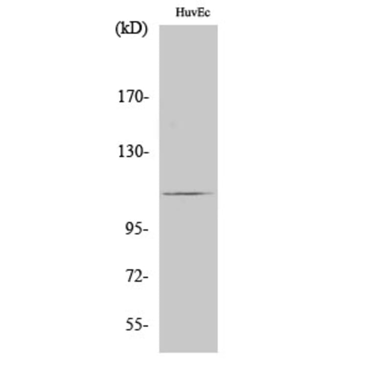 Western Blot - Anti-RIN3 Antibody (C11385) - Antibodies.com