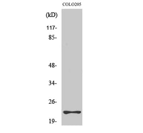 Western Blot - Anti-RHOD Antibody (C18411) - Antibodies.com
